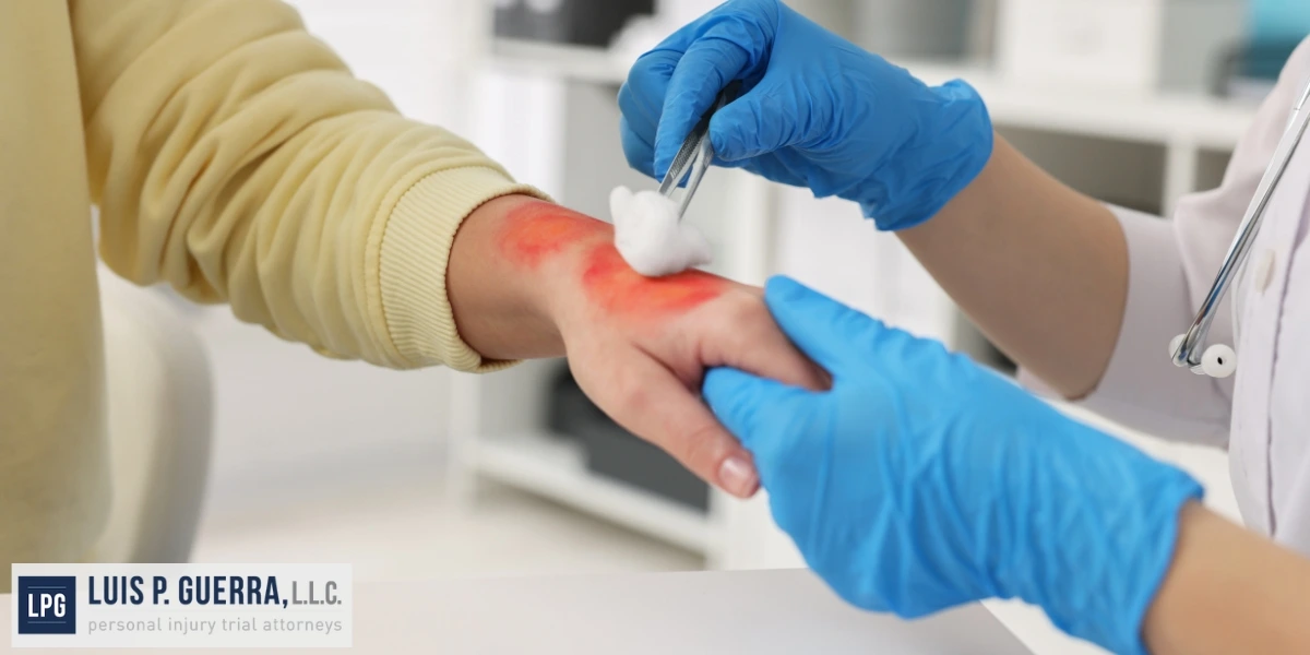 Best Phoenix Burn Injury Attorney