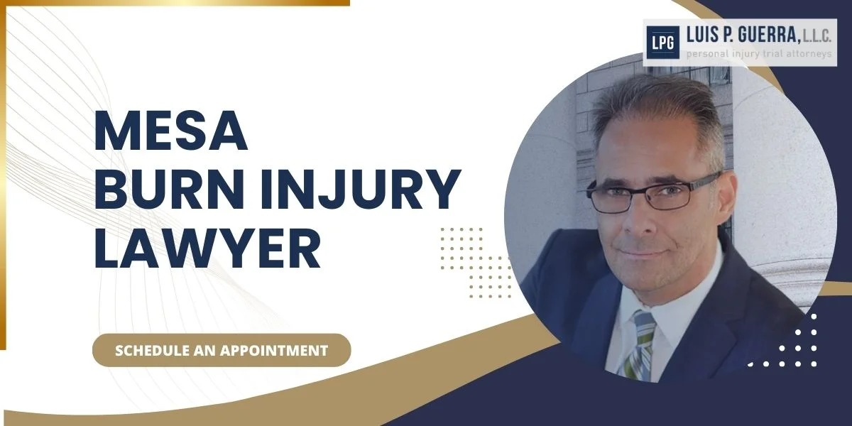 Burn Injury Attorney In Mesa, AZ